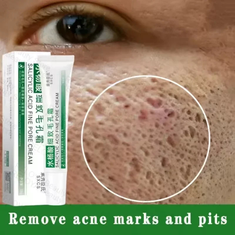 Pore Shrinking Cream – 1pc

💰 Price: €12.99
🧴 Reduces large pores & blackheads.
🌿 Repairs acne scars & tightens skin.
✨ Smooth, clear & fresh look.